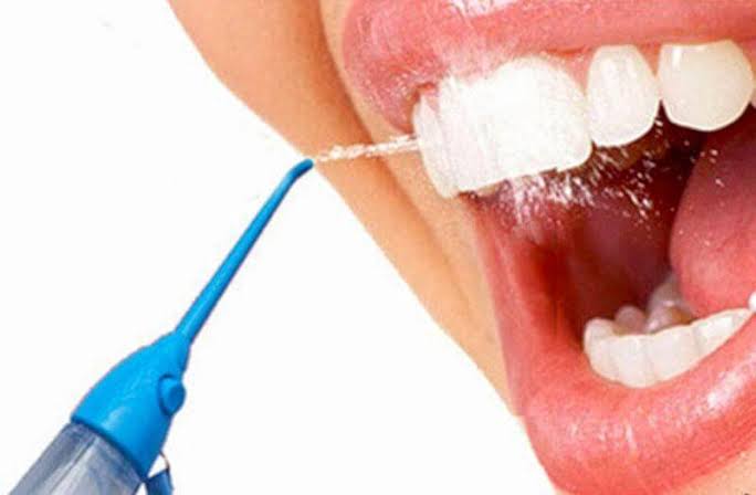 IRRIGADOR DENTAL(80 UND X CAJA) 3 COLORES