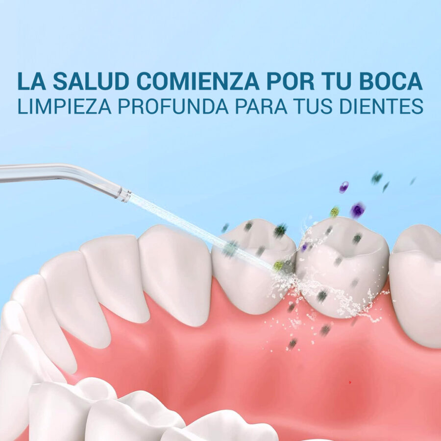 IRRIGADOR DENTAL(80 UND X CAJA) 3 COLORES